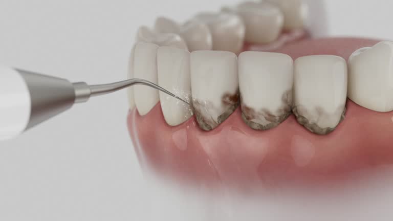 Trusted Dental Crowns And Bridges service in Roxboro, NC - Dentist Open Now